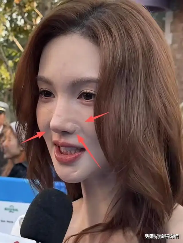 金晨鼻子翻车 高清镜头暴露疤痕 网友质疑演技外貌_女明星脸上有疤痕